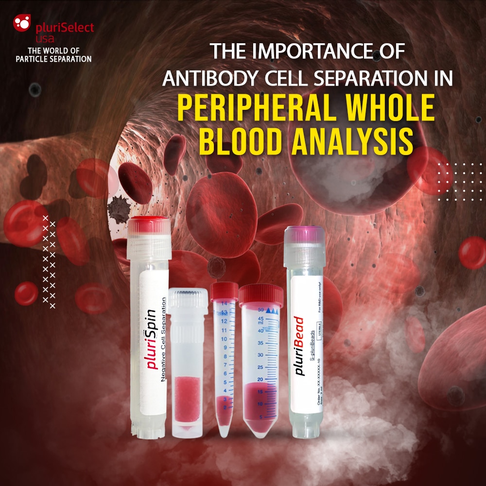 Importance of Antibody Cell Separation in Peripheral Whole Blood Analysis...