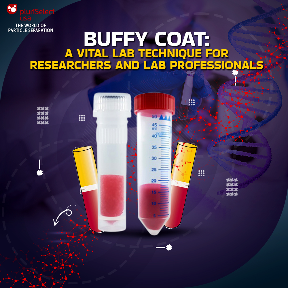 Buffy Coat: A Vital Lab Technique for Researchers and Lab Professionals...