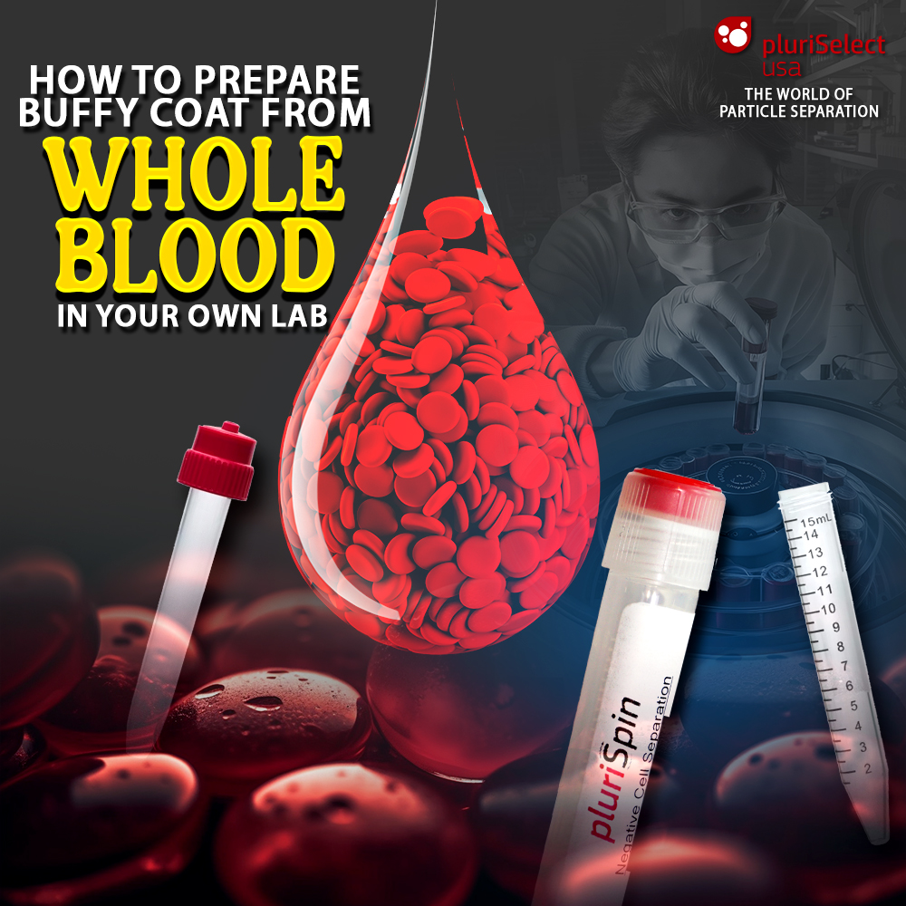 How to Prepare Buffy Coat from Whole Blood in Your Own Lab